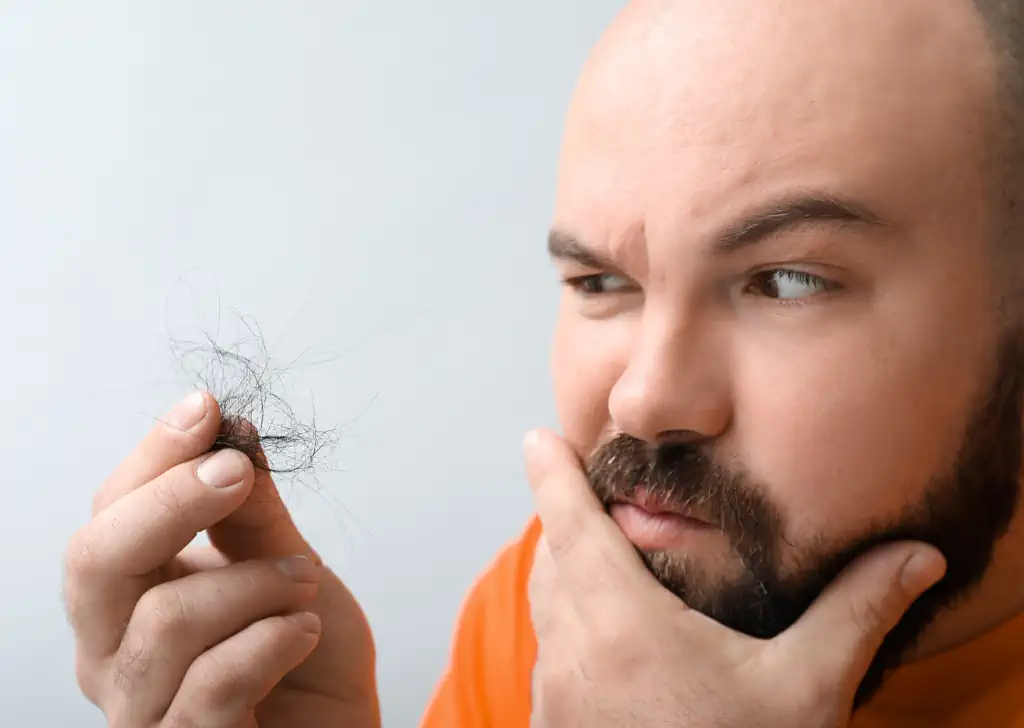 What to pay attention after hair transplant surgery?